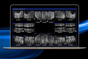 DentiMax Dental Software - X Rays